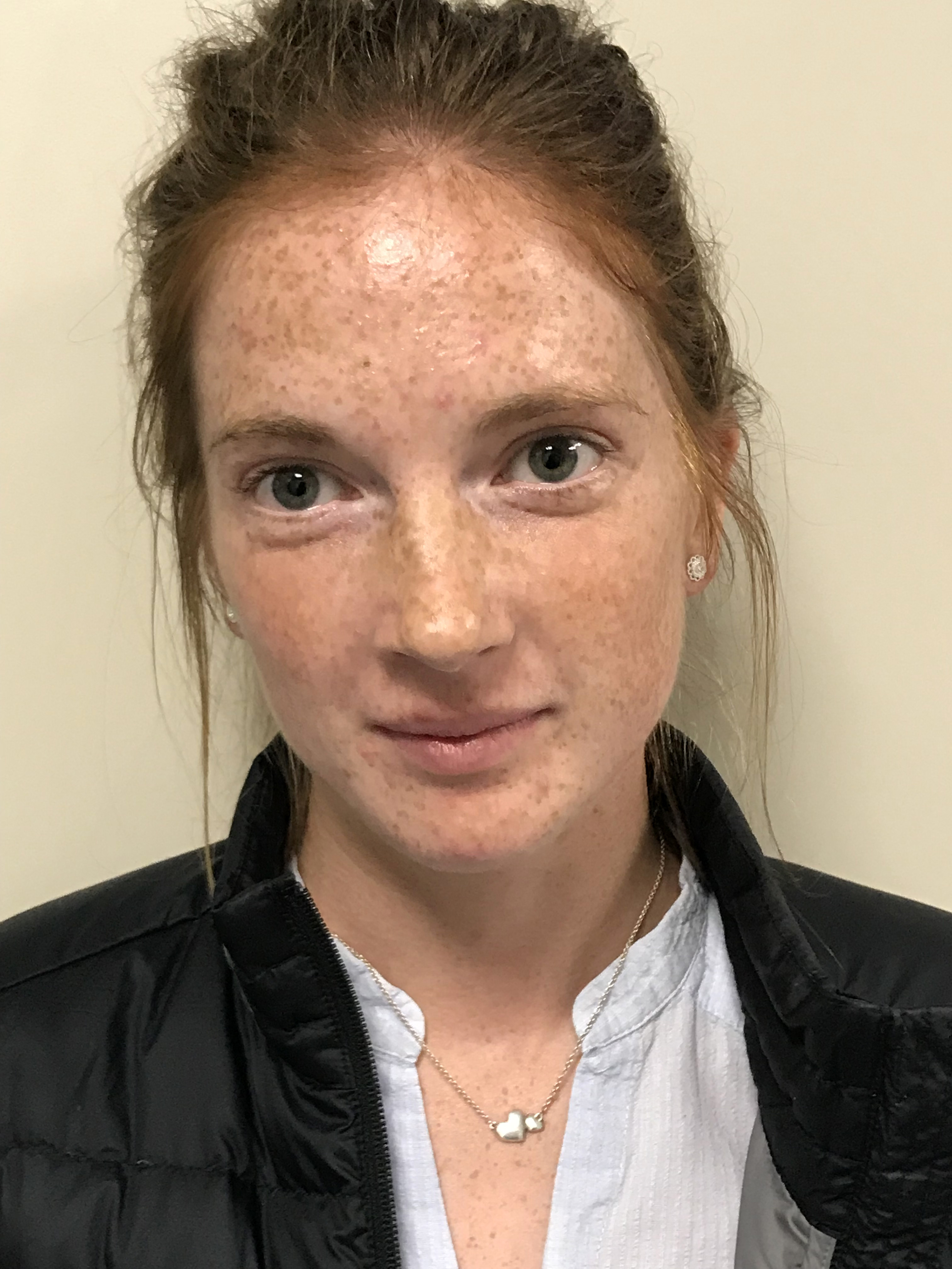 Dr Aine Rowe
